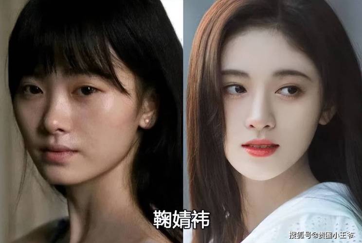 王柳雯扒皮整容前照片：网红争议与公众反思