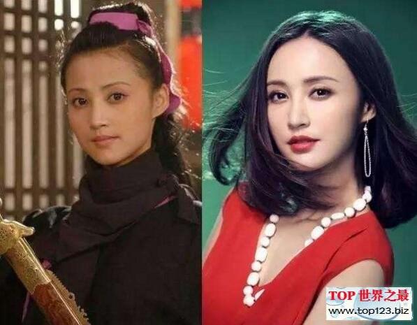 王柳雯扒皮整容前照片：网红争议与公众反思