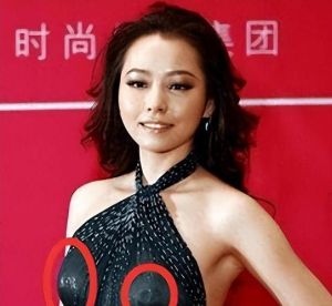 张靓颖乳环争议 明星个人选择与健康影响探讨