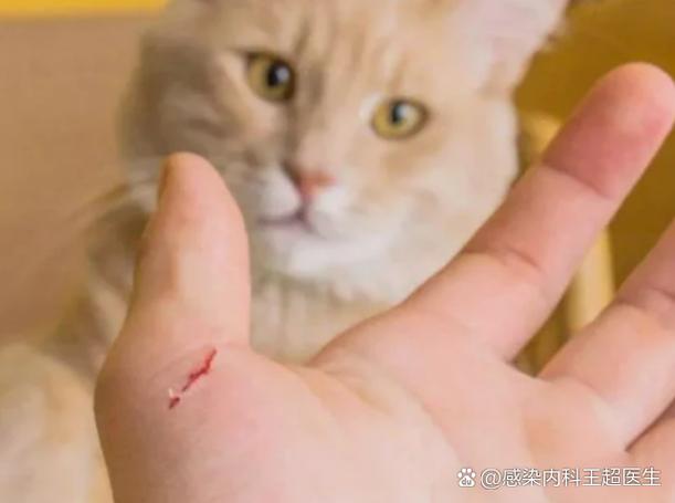 猫爪子抓破了用打针吗,猫抓了别慌?看伤口打针? 猫爪子抓破了用打针吗,猫抓了别慌?看伤口打针?