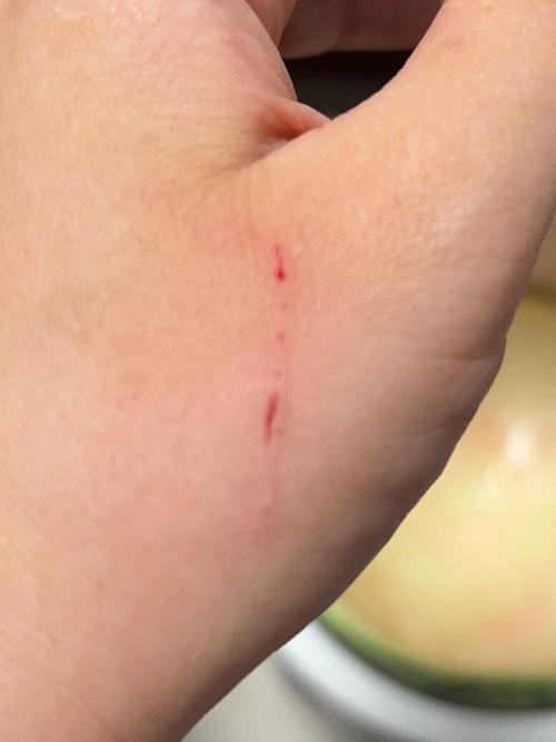 打完狂犬疫苗一个星期被猫抓了，打完狂犬疫苗被猫抓？别慌，正确处理很重要！