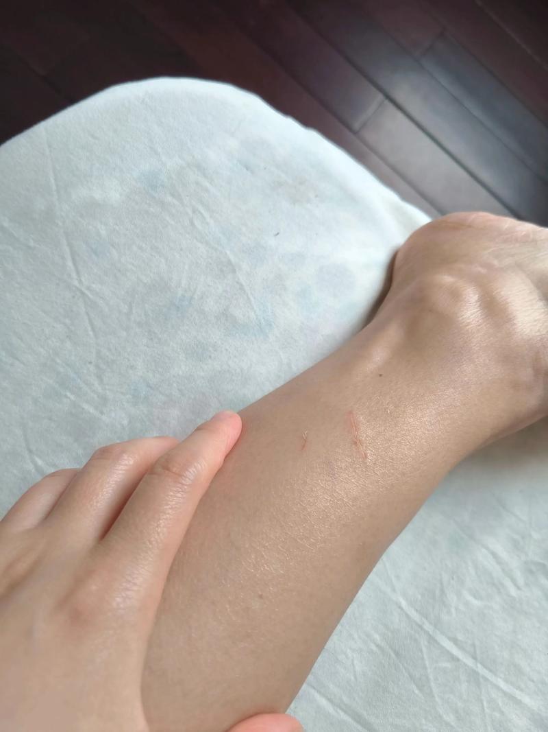自家猫轻微抓伤要不要打针,猫抓破皮,需打针吗?速洁消毒,看猫情况! 自家猫轻微抓伤要不要打针,猫抓破皮,需打针吗?速洁消毒,看猫情况!
