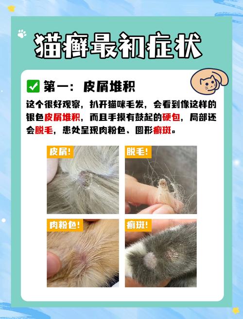 猫毛吸多了有什么危害,猫毛吸入影响大吗?医生解读过敏原与应对 猫毛吸多了有什么危害,猫毛吸入影响大吗?医生解读过敏原与应对